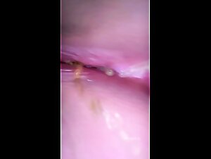 Thumb 9